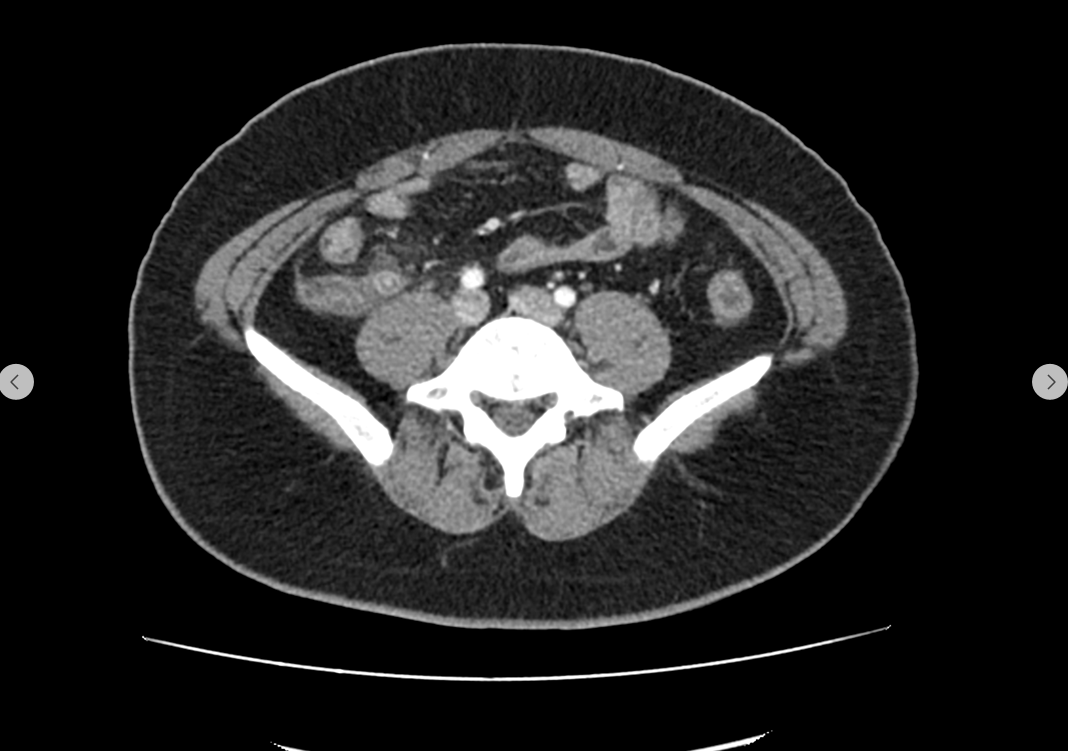 조영증강 복부·골반 CT 사진 1 · 파인메디내과 제공