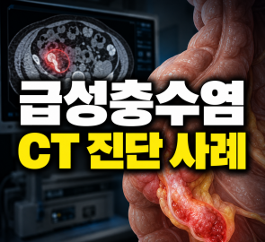 안산 파인메디내과의원 급성충수염 진단사례 썸네일